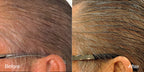 MD Color Restoration drug-free foam applied to gray roots at the hairline